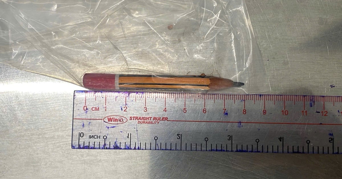 Un garçon de 5 ans a coincé un crayon dans l'anus et a eu besoin de soins d'urgence