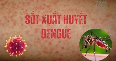 Warning of the risk of dengue fever outbreak out of season