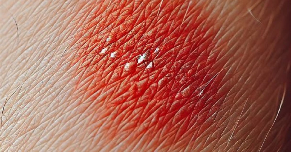 Red spots on the skin warn of cancer