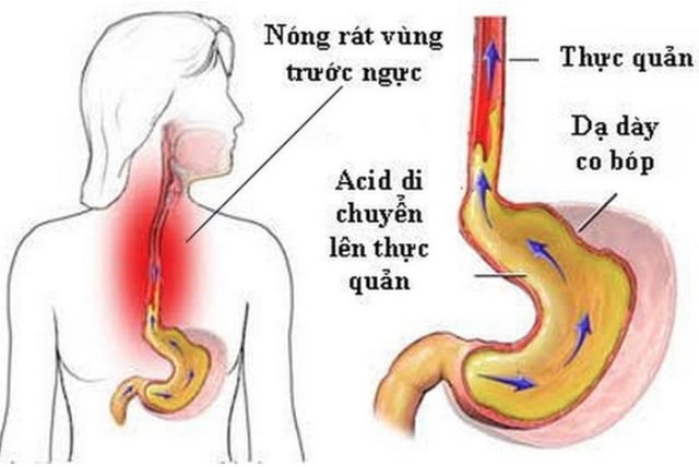 Ho dai dẳng nhiều tháng không khỏi, người phụ nữ 39 tuổi đi khám phát hiện nguyên nhân bất ngờ - Ảnh 2.