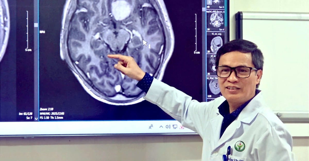 Primera vez en Vietnam: extirpación de un tumor cerebral mediante una incisión endoscópica en la ceja