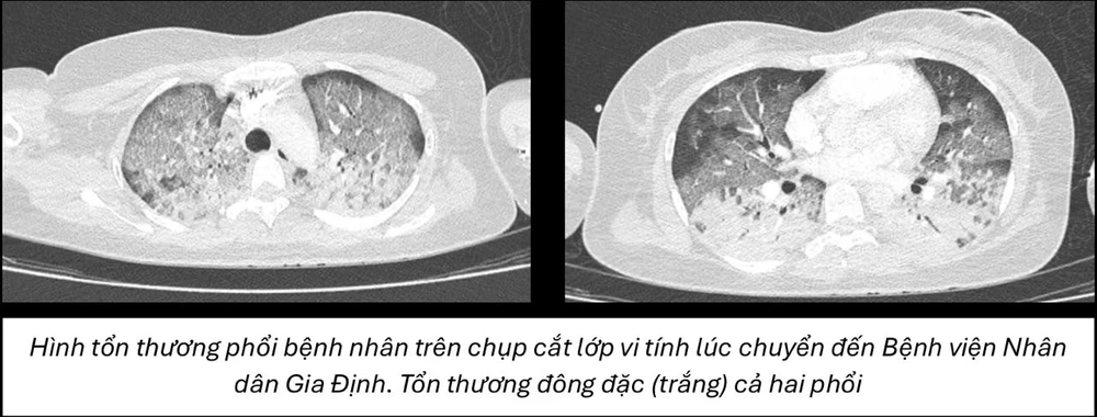 រូបភាព 1.jpg