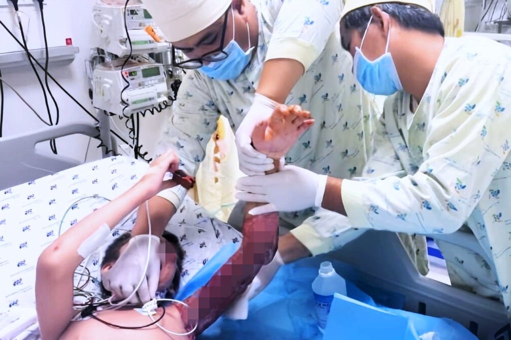 Bé trai người Nga bị tai nạn nguy kịch và cuộc níu mạng đặc biệt ở Việt Nam - 2