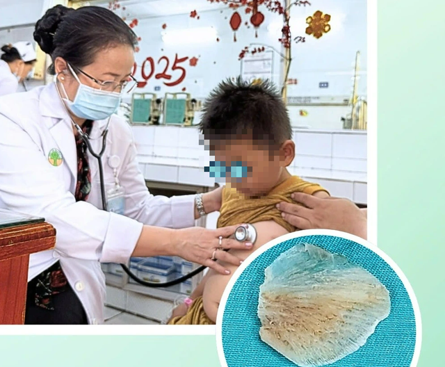 Bác sĩ cảnh báo nhiều trẻ uống nhầm hóa chất, hóc xương cá - Ảnh 1.