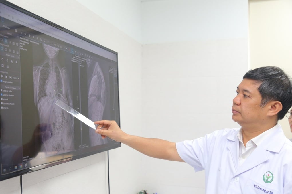 Điều cần chú ý để phát hiện trẻ bị vẹo cột sống trước 10 tuổi - 2
