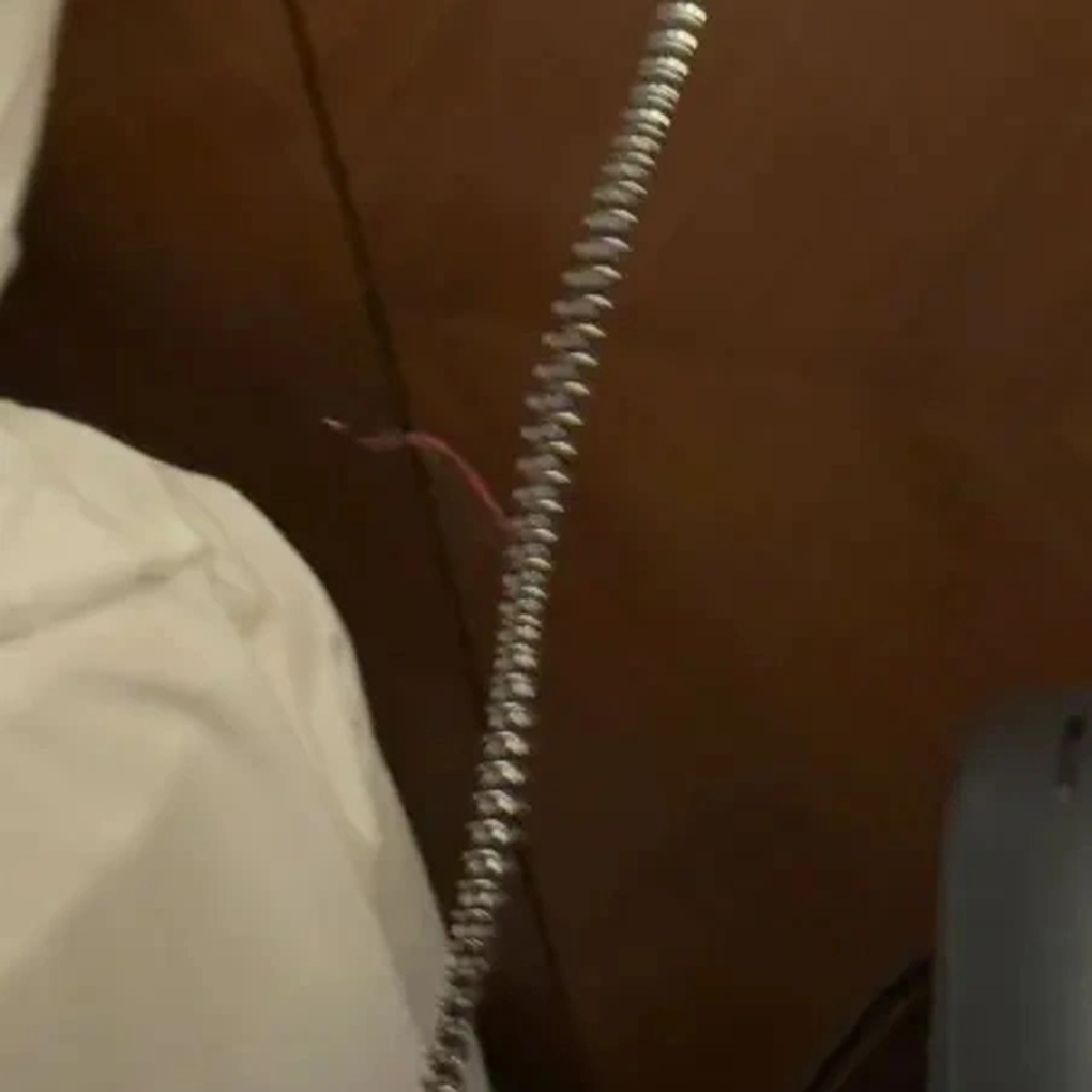 5성급 호텔에서 예상치 못한 작은 물체에 맞아 거의 감전사한 손님 - 2