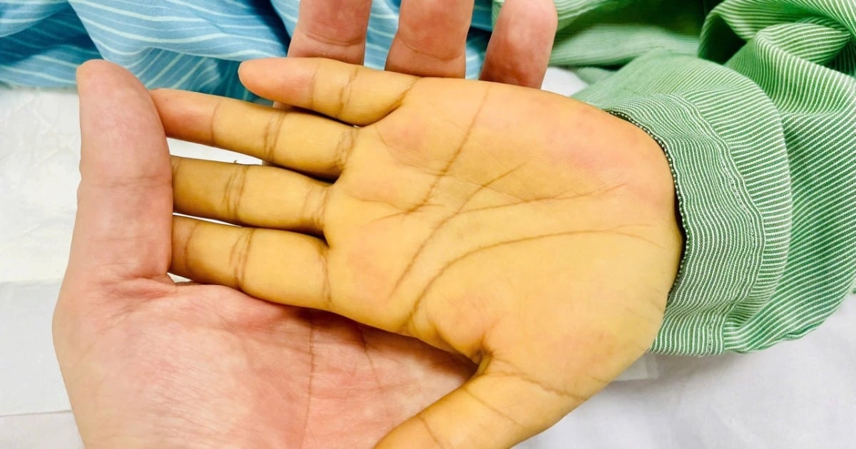 一般的な病気でほとんど死にかけている黄色の皮膚の女性