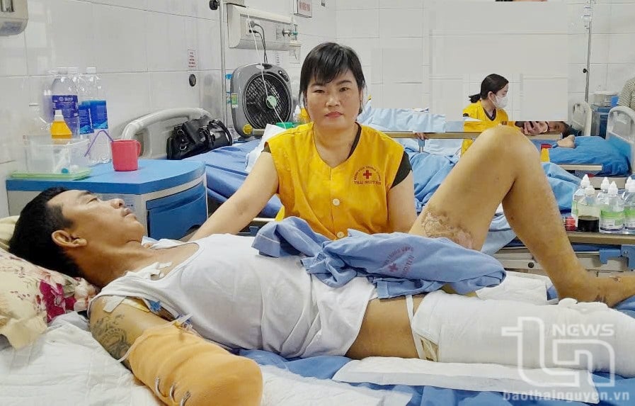 Anh Đàm Quang Trung đang được điều trị tích cực tại Bệnh viện Trung ương Thái Nguyên.