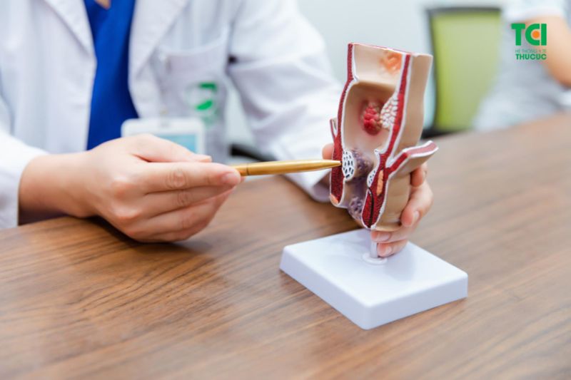痔からの出血は健康に悪影響を及ぼす可能性がある（写真：TCI）