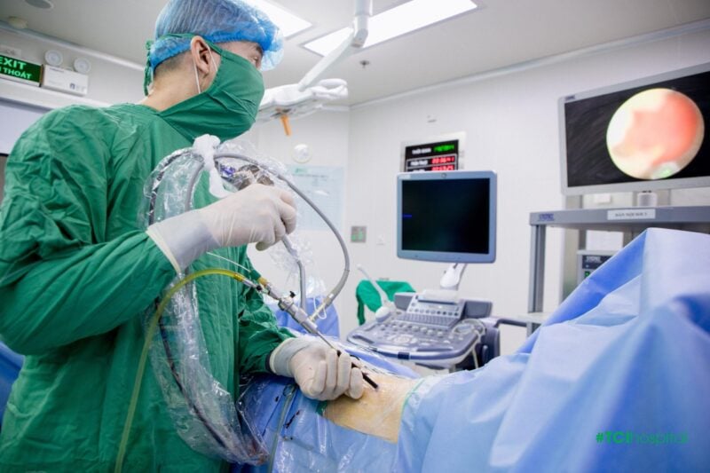 Cân não” tán sỏi san hô khổng lồ bảo toàn sức khỏe cho bệnh nhân hậu tai biến