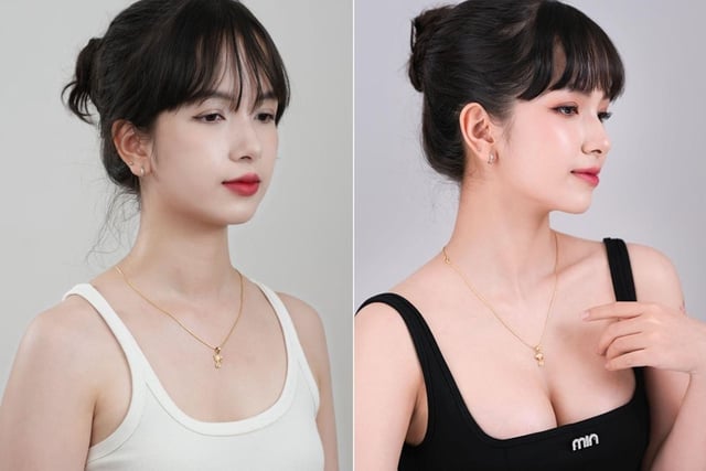 Bệnh viện thẩm mỹ Nam An nâng tầm trải nghiệm phẫu thuật nâng ngực về trong ngày- Ảnh 4.