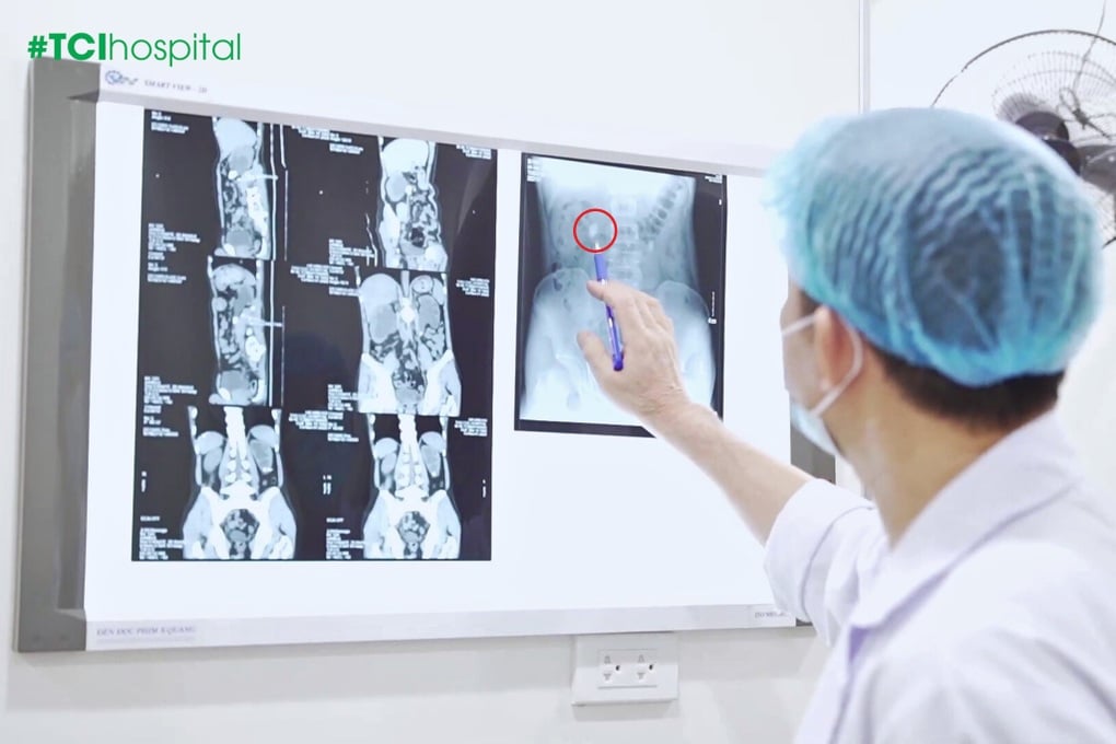 Cứu hai quả thận khỏi bờ vực suy thận từ biến chứng giãn nặng - 2