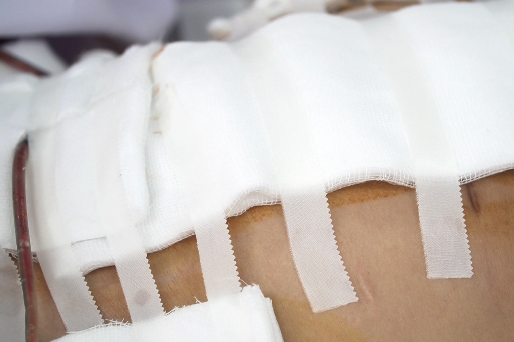 Vụ tai biến sau hút mỡ ở TPHCM: Nạn nhân tha thiết mổ dù có bệnh nền? - 1
