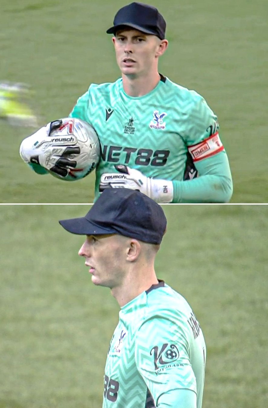 Dean Henderson ist heiß 1