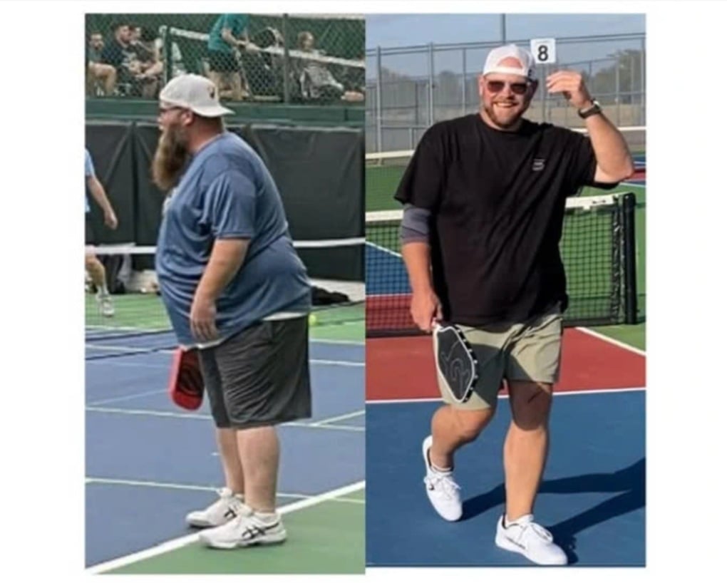 Vận động viên người Mỹ giảm hơn 90kg nhờ chơi pickleball - 2
