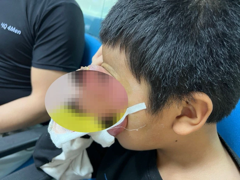 Niño con un tumor 