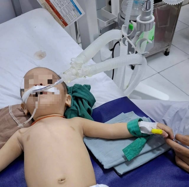 Cần Thơ: Liên tục có nhiều trẻ nhỏ bị hóc, sặc dị vật nguy hiểm tính mạng - Ảnh 1.