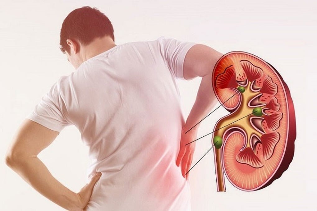5 món càng dùng nhiều, thận càng nhanh hỏng - 1