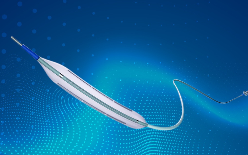 Can thiệp thành công cho bệnh nhân tái hẹp nặng mạch vành sau 15 năm đặt stent - 2