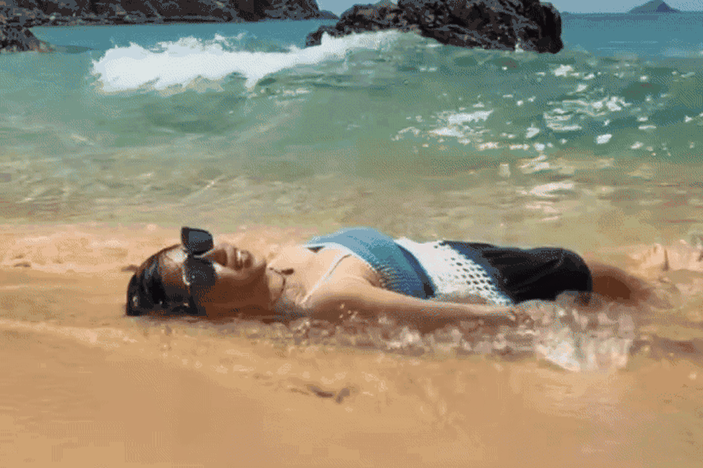 Mặc bikini đu trend ở biển, cô gái Hà Nội tìm bác sĩ sau chuyến du lịch - 1