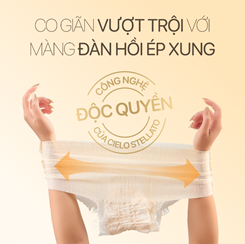 Cielo Stellato Mini - Băng quần 'quốc dân' cho mùa hè - Ảnh 3.