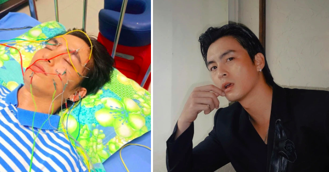 Diễn viên Lãnh Thanh bị liệt dây thần kinh số 7