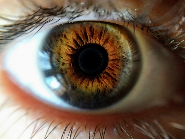 Quelles maladies oculaires une hypertension artérielle prolongée peut-elle provoquer ? - Photo 1.