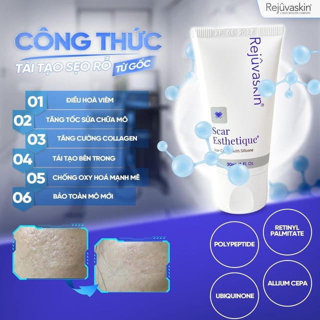 Scar Esthetique: 'Gỡ rối' sẹo rỗ đỏ sau mụn - Bí quyết từ chuyên gia- Ảnh 3.