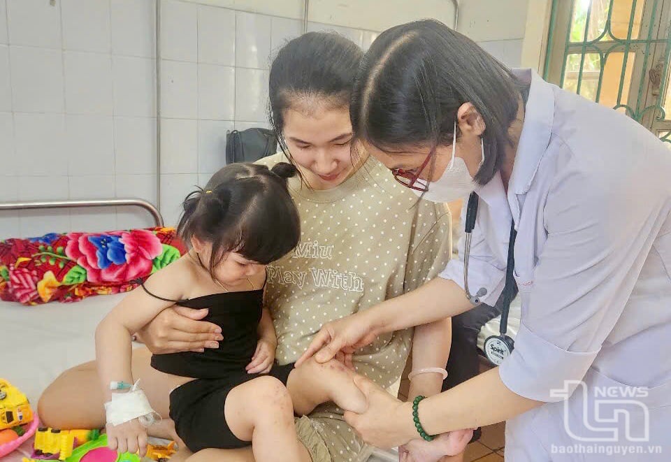 Trẻ mắc bệnh tay chân miệng khi có dấu hiệu nặng đều được các bác sĩ theo dõi sát, dùng thuốc hạ sốt, an thần sớm để chống co giật.