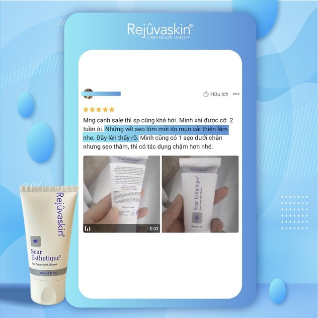 Scar Esthetique: 'Gỡ rối' sẹo rỗ đỏ sau mụn - Bí quyết từ chuyên gia- Ảnh 4.