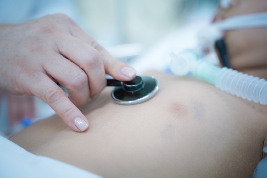 Bé trai bị cành cây rơi giữa đường làm nứt sọ, Thứ trưởng chỉ đạo đặc biệt - 2