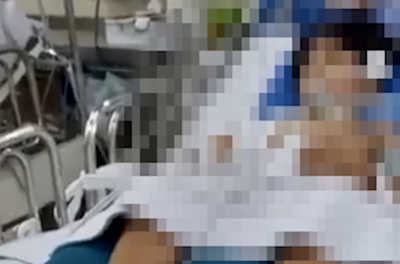 Bé trai 10 tuổi tiên lượng xấu vì bị nhánh cây rơi vỡ hộp sọ -0
