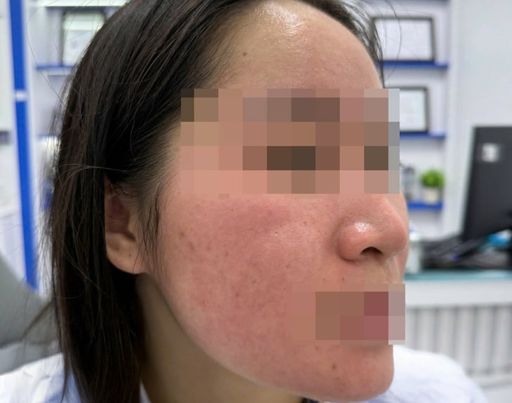 nước cốt chanh - Ảnh 1.