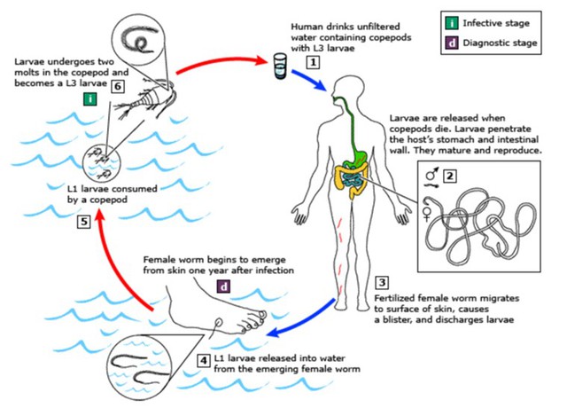 ¿Qué causa la infección del gusano dragón? ¿Es peligrosa? - Foto 1.