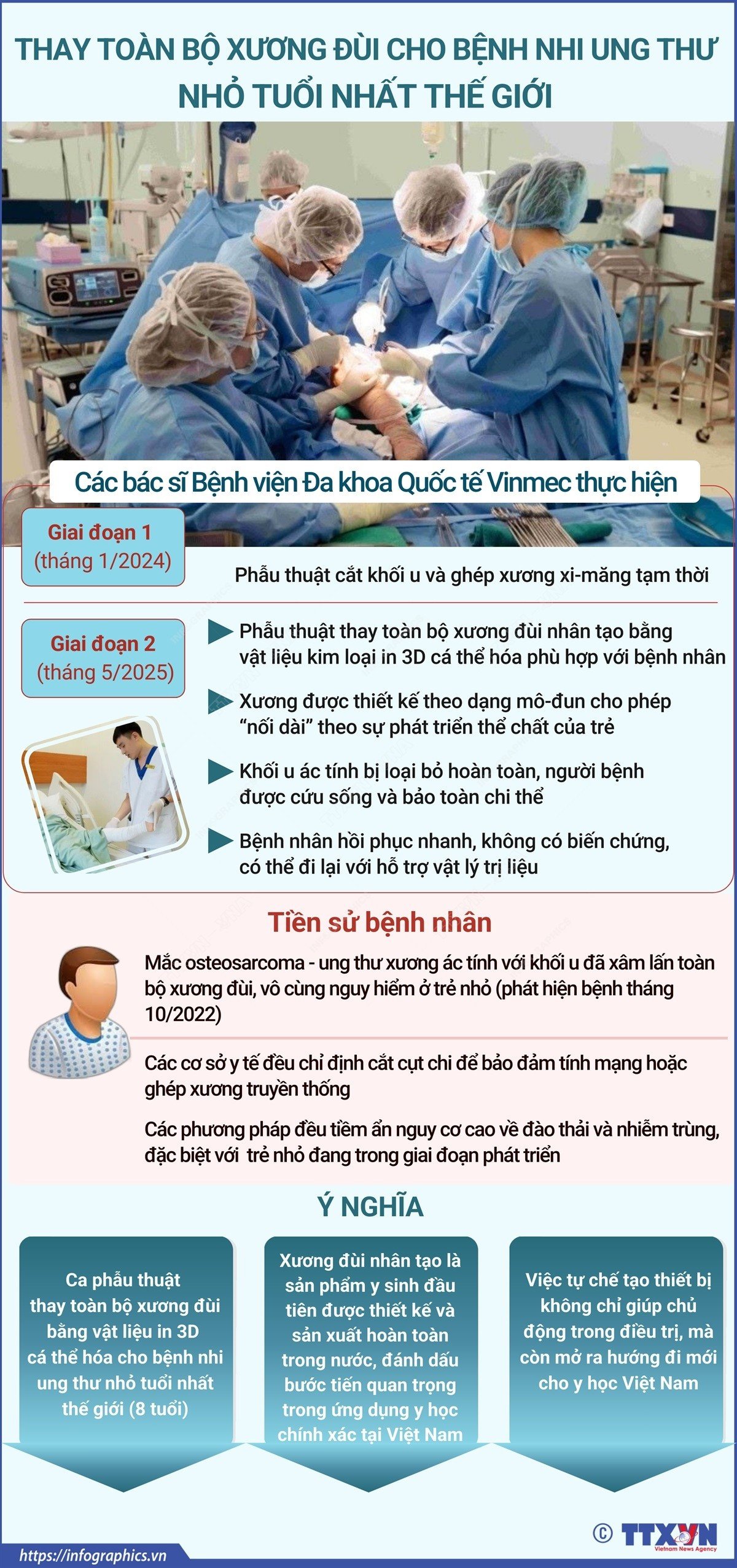 vna-potal-thay-toan-bo-xuong-dui-cho-benh-nhi-ung-thu-nho-tuoi-nhat-the-gioi-8085157.png