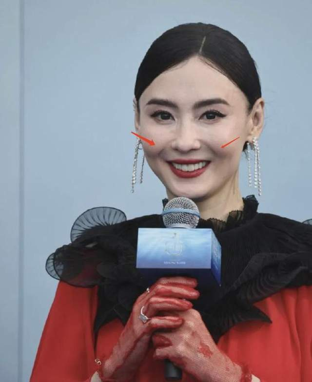 Trương Bá Chi bỗng trẻ lạ ở tuổi 45, bị nghi can thiệp thẩm mỹ - 6
