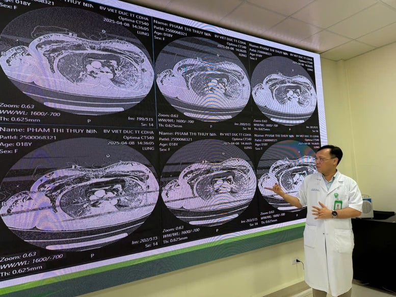 Bệnh nhân bị vỡ phế quản gốc 2 bên hiếm gặp vừa được cứu sống ngoạn mục- Ảnh 1.