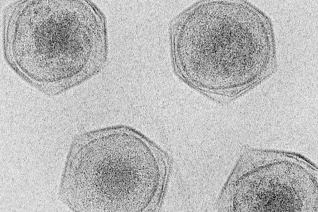 Phát hiện hơn 230 virus khổng lồ, kích thước vượt xa thông thường - 1