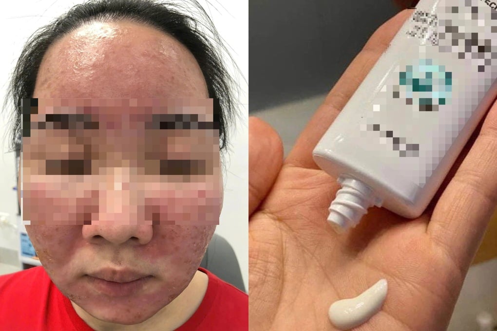 Tin kem chống nắng nổ trên mạng xã hội, mặt nữ sinh nở hoa - 1