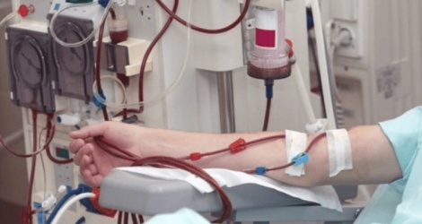 Chronic kidney failure is getting younger and increasing.