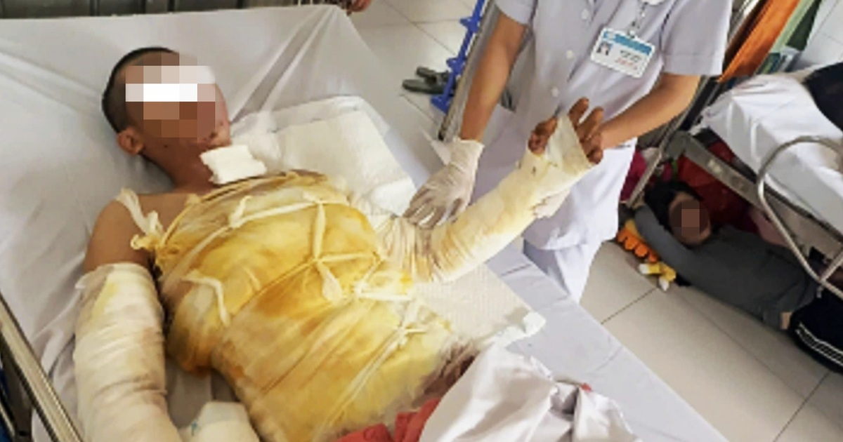 Sửa đèn bảng hiệu, người đàn ông 32 tuổi bị điện phóng gây bỏng nặng