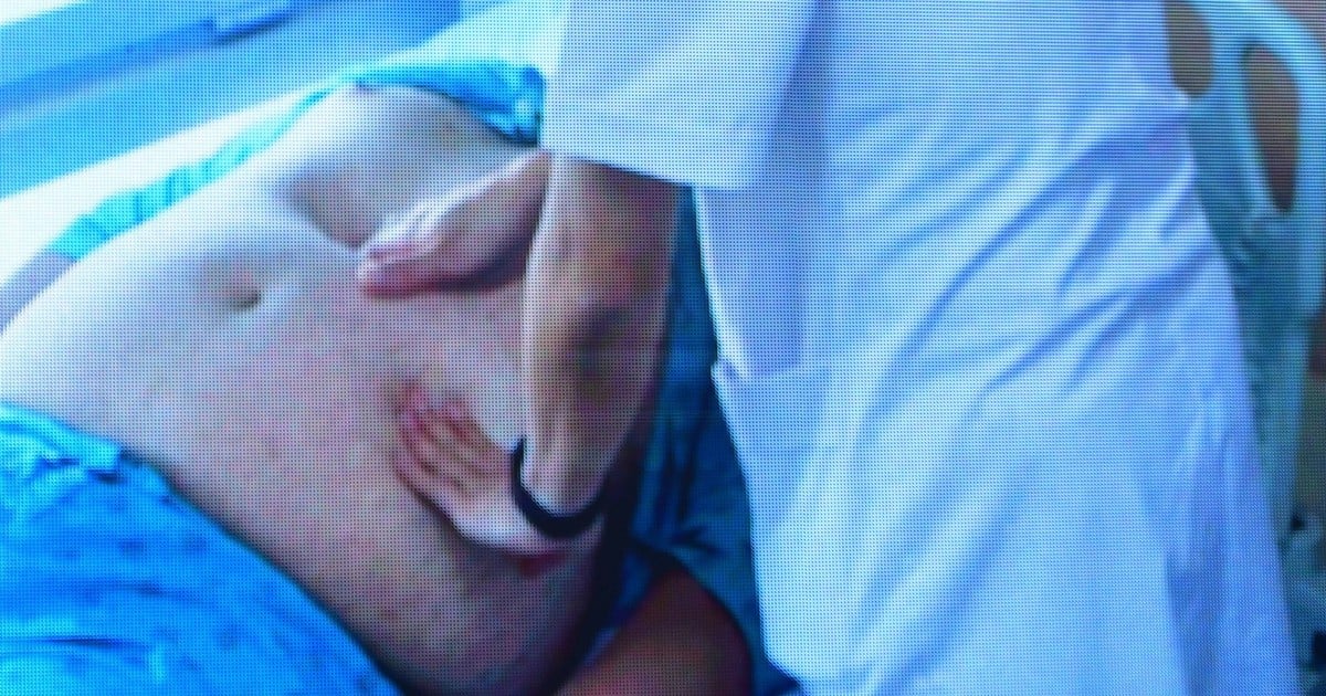 Béo phì có phải là bệnh?