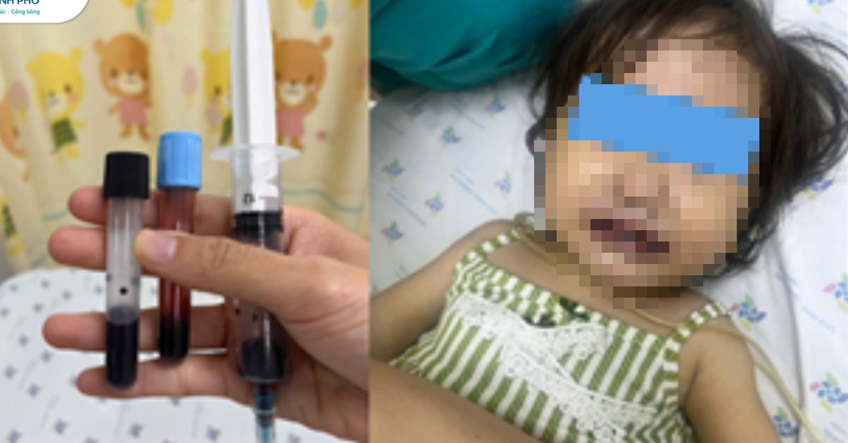 Máu của bé gái chuyển qua màu nâu sau khi ăn canh nấu bằng nước giếng