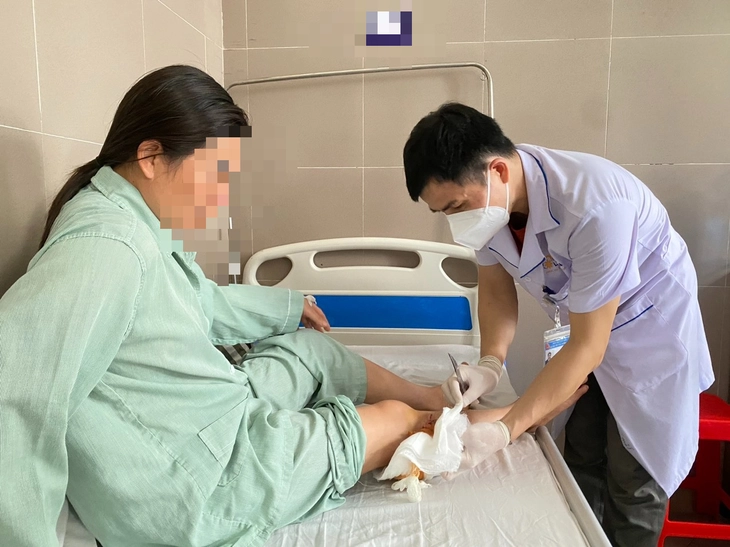 Chó cắn nhập viện tăng gấp 4 lần: Cảnh báo mùa hè dễ phát bệnh dại - Ảnh 1.