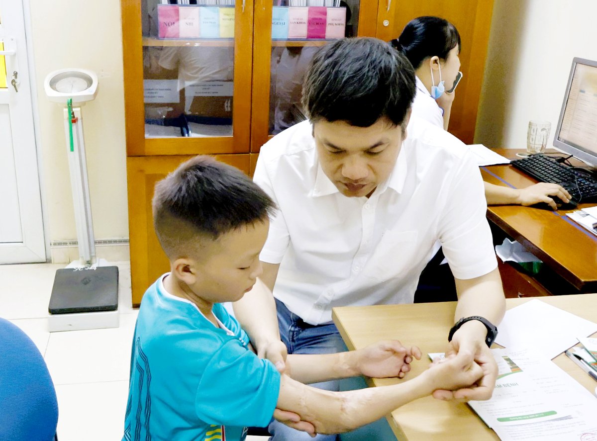 Bác sỹ khám cho một bé trai bị dị tật co rút bàn tay do di chứng bỏng.