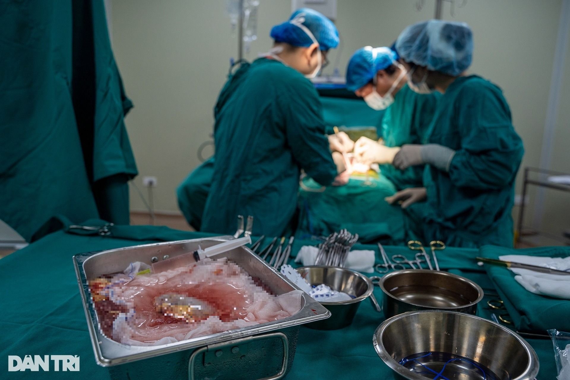 Cận cảnh 30 y bác sĩ giải cứu cô gái suy thận 10 năm không thể uống nước - 17