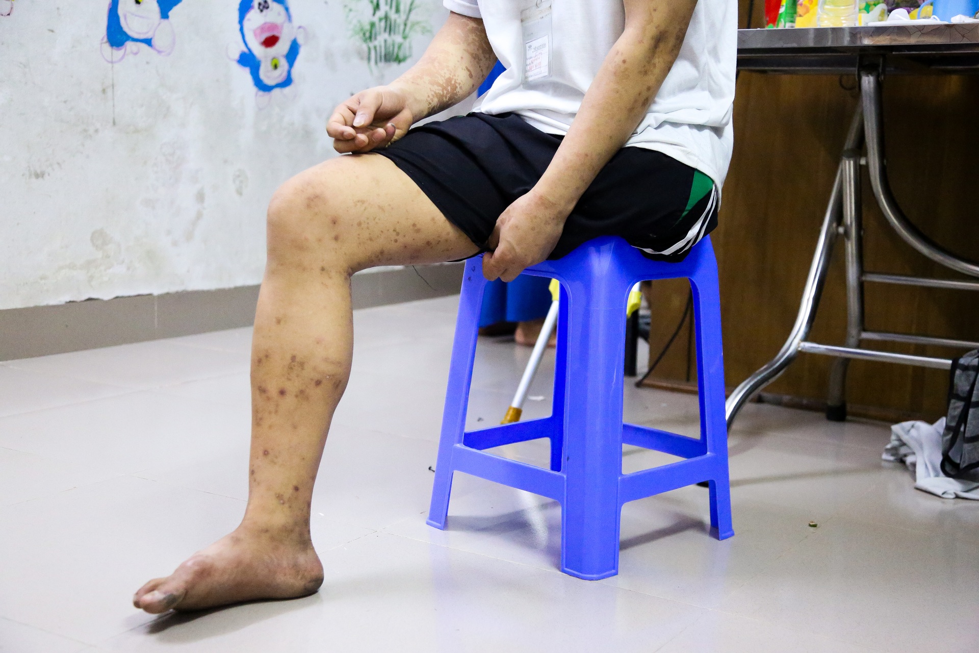 Những gia đình cùng kiệt vì viện phí, mẹ bán nhà đổi vài năm sống cho con - 7