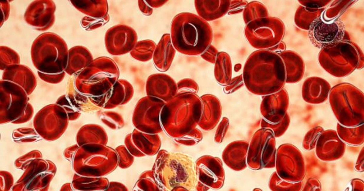 Breakthrough test helps detect leukemia risk