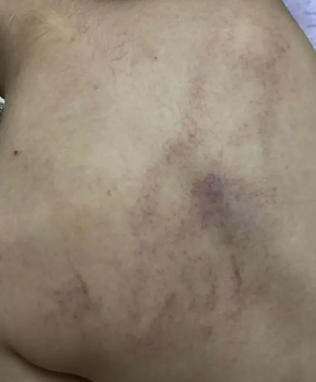 Bé 4 tuổi bị giáo viên bạo hành: Công an khám nghiệm hiện trường, đưa trẻ đi giám định thương tích ảnh 2
