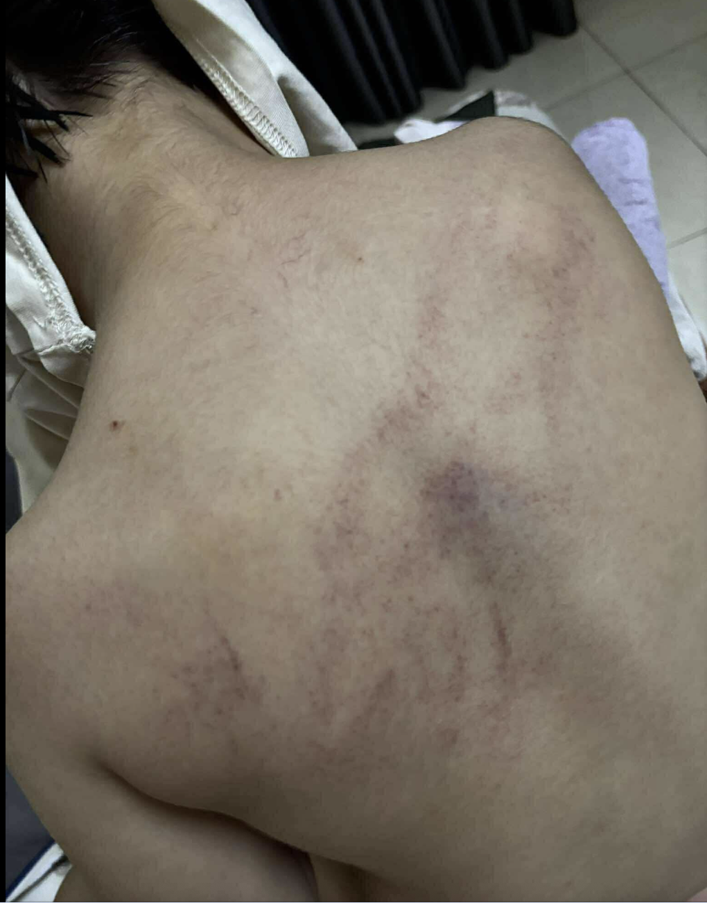 Vụ trẻ nghi bị giáo viên mầm non bạo hành: Công an vào cuộc xác minh - 1